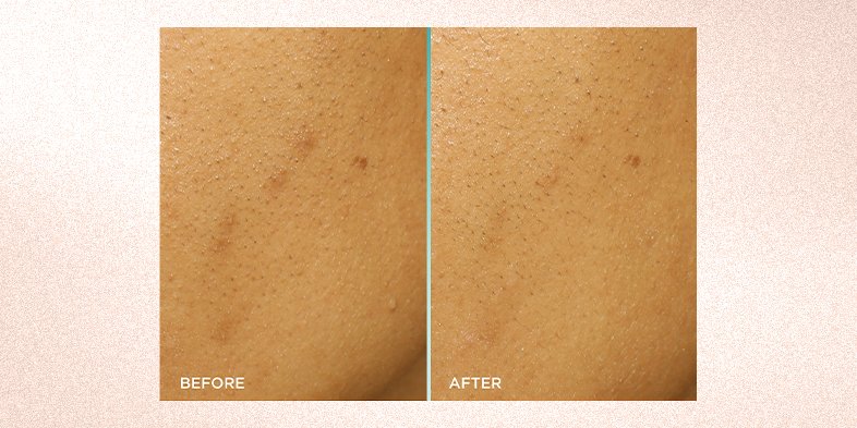In-Article-common-signs-of-dull-skin_3